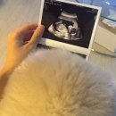 가연약국 | B 11_임신 14주~19주 증상 기록 (임신중기 진입! 태동 느끼는 시기, 확장통, 배땡김 통증)