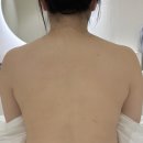 금화로 | 광주 승모근관리 받고 온 메이블 에스테틱 테라노바 에너지 후면관리 솔직후기