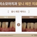 미소나래치과의원 이미지