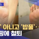 '각질' 아니고 '밥풀'‥홈쇼핑에 철퇴 이미지