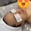미인메디에스테틱 | 신중동 에스테틱 부천피부관리 아우슈라메디에스테틱에서 마이크로MTS 받은 후기