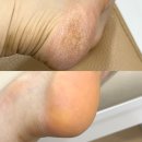 엔피케어 - 중구 종가6길 4-5 | 연산동발관리 패디플래닝 잘하는곳 엔피케어 발각질제거 후기