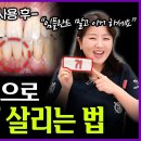 비트덴탈 이미지