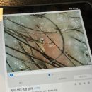 지후헤어 - 수영구 호암로 48 | 홍대 헤어더뷰 지후 실장에게 두피클리닉 후기 홍대역 미용실