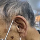 프리미엄보청기 계양센터 이미지