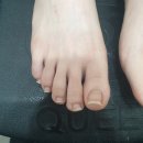 809 | 효창공원앞역 네일샵 :: 네일뮤지엄 내성발톱 케어