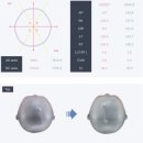 비바 두상교정헬멧 단두아기 2개월 변화 후기 +추천인코드