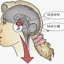 성장호르몬 치료 이미지