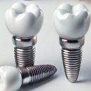 새로나병원 | 충주시 임플란트 치과 가격 싼곳,저렴한곳,잘하는곳 추천 BEST10