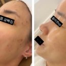 이쁜 피부 부탁해