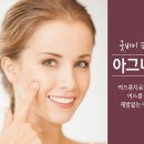 아그네스 이미지