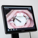 서울플란트치과의원 | 이제 치과 가도 안 무서움!! 플란트 서울 치과의원 내돈내산 정복기