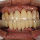 뉴치과기공소 이미지