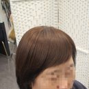 김호증모가발by헤어리서치