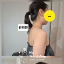 🙋‍♀️사무직 고객님의 굽은 어깨. 2회 관리로 목선.뒷태 라인 변화 후기!!🙋‍♀️