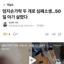엄지손가락 두 개로 심폐소생…50일 아기 살렸다 이미지