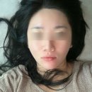 도일약국 | 명동피부과 티타늄리프팅 풀페이스 후기 명동역 다이어트 리프팅 시술 추천