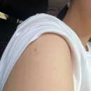 동탄보건소 | 동탄 보건소 B형 간염 예방접종 후기, 통증, 가격, 접종 주기