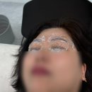 어드반SMP | 어머니 모시고 다녀온 내돈내산 안산눈썹 문신 제거, 어드반 솔직 리뷰