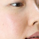 (주)편한피에이치 | 피지제거 민감할수록 자연스럽게! 티큐라 아크솔 솔직후기