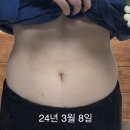 베이킹25(BAKING 25) | 마른비만 다이어트 후기 | 체지방률 33% → 25% 유지중