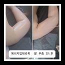 디에스약초 | 진해피부관리 "에너지업" 후기