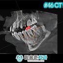 은천동-46 네이버블로그