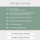 유어린