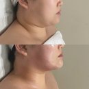 리파인 더 핏 | 비하동 피부관리 찾는다면상담부터 편안했던 더리파인 후기