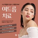 뮤즈클리닉일산점 네이버블로그