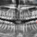 이하루치과의원 이미지