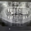 예온치과병원 이미지