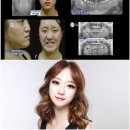 렛미인