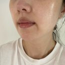 별인셀덤 | 임산부 기미관리화장품 인셀덤화장품사용후기