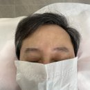 자연.이미지 | ✔️ 인천 영종도 남자 눈썹 콤보기법 시술 후기 | 자연스럽고 또렷한 이미지 완성!