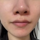 505 | 약산성토너 닥토추천 닥터 505 아토클토너 실사용 후기, 예민한 피부도 세라마이드로 순하게