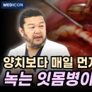 잇몸병 없애는 가장 확실한 방법. 집에서 잇몸 싱싱하게 살리는 법. 이미지