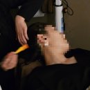 하루두피 수원광교점 | 광교탈모 수원 두피관리 모디슨 광교점 후기