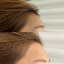 유앤헤어 | 대전 서구 왁싱 잘하는 곳｜유앤뷰티 뒷목·헤어라인 왁싱 후기