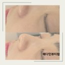 예다인뷰티랩 | 남포동 피부관리 예다인뷰티랩 에서 물광피부관리후기