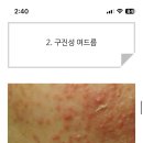 여드름 약 처방 받은 제이비들아 얼마나옴?? 이미지