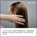 웰킨두피탈모센터 이미지