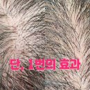 탈모퀸 이미지