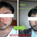 부신모사 이미지