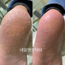 네일앤풋닥터 네이버블로그