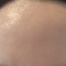 김은영 피부관리 네이버블로그