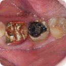 삼성플란트치과의원 이미지