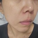 (주)바로닥터 | 닥터비타 프리미엄C크림, 프리미엄 마스크팩 후기