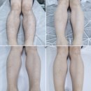 아나덴슈가링왁싱분당야탑역점