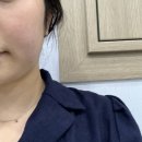 구올담치과병원 | 사랑니 맛집에서의 매복 사랑니 4개 발치 생생 비교 후기 [ 부평 구올담 치과병원 ]